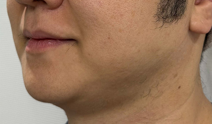 ダイヤモンドチップ