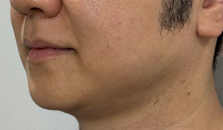 ダイヤモンドチップ